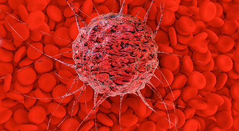 Das Forschungsteam konnte 11.000 Genmutationen auf ihre Bedeutung in Krebszellen bewerten. (c)Fotolia