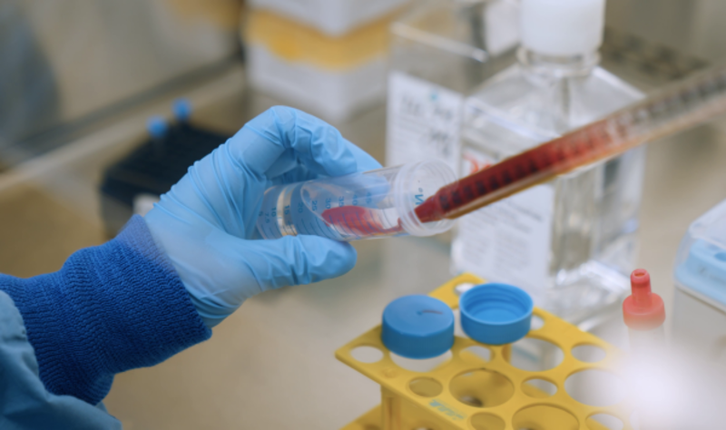 Blood samples from hepatitis C patients were analyzed in the laboratory, revealing significant changes. ©Medical Center – University of Freiburg