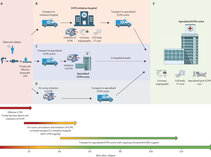 Supady et al. Extracorporeal cardiopulmonary resuscitation for refractory cardiac arrest. Lancet Resp Med 2025