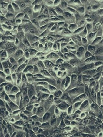 Zellen einer CNV-RPE-Zellkultur