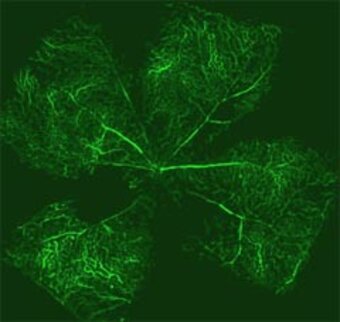 Retina einer Maus mit retinalen Gefässen, die durch Perfusion mit einem Fluoreszenzfarbstoff (Fluorescein) sichtbar gemacht wurden.