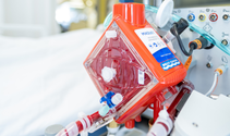 Many patients with severe lung failure are fighting for their lives in the intensive care unit. In particularly severe cases, extracorporeal membrane oxygenation (ECMO) may be used. ©Medical Center – University of Freiburg/Britt Schilling