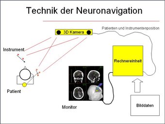 Technique of neuro navigation