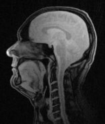 Mid-Sagittal view of the head