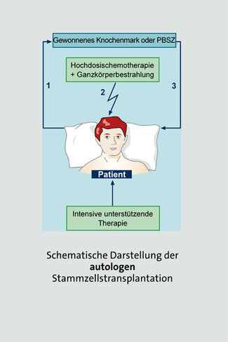 Autologe Stammzelltransplantation