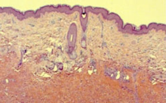 Hämatoxilin Eosin gefärbter Hautschnitt