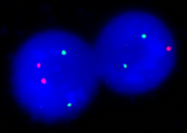 Fluoreszenz-In-Situ Hybridisierung