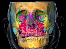 Sequenzierter Gesichtsschädel