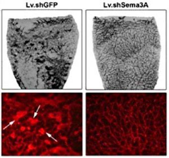 Neuronale Leitmoleküle als angiogene Regulatoren