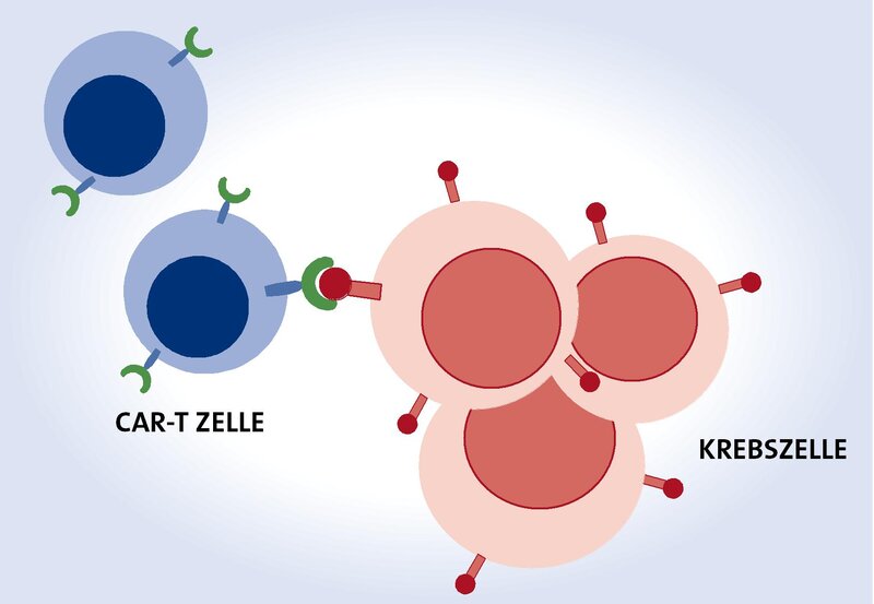  CAR-T Zelltherapie