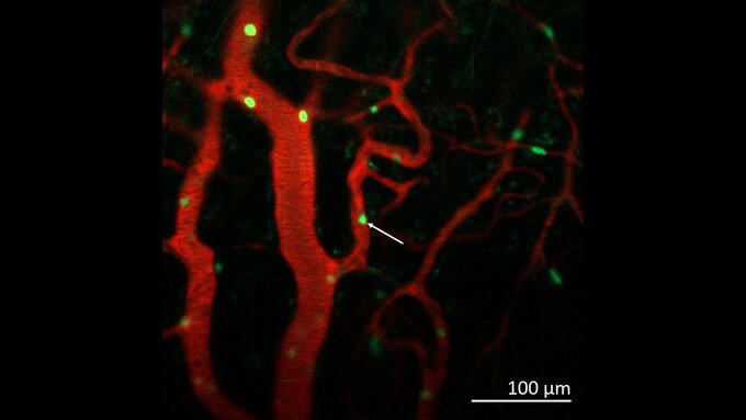 CD68-GFP monocytes show endothelial cell interaction and patrolling non-classical monocyte (arrow)