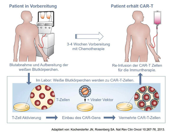 Immunzell-basierte Therapie / CAR-T