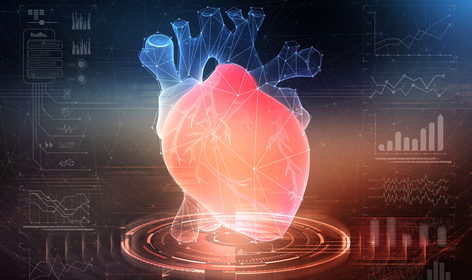 A recent case shows: In cases of acute chest pain, every minute counts - the correct diagnosis of "aortic dissection" saved lives in this case. ©Photolia A recent case shows: In cases of acute chest pain, every minute counts - the correct diagnosis of "aortic dissection" saved lives in this case. ©Photolia