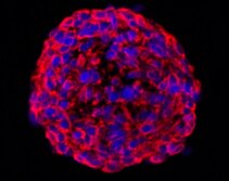 Brain tumor isolated cells Brain tumor isolated cells