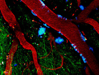 2-Photon microscopy 2-Photon microscopy