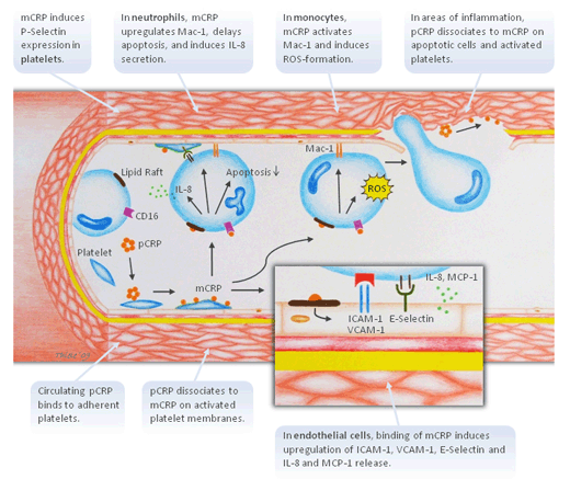 Inflammation and reperfusion injury | Universitätsklinikum Freiburg